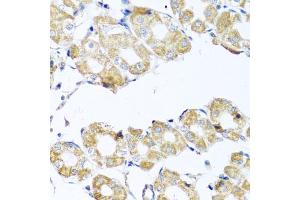 Immunohistochemistry of paraffin-embedded human stomach using COQ7 antibody (ABIN5975182) at dilution of 1/100 (40x lens). (Coq7 anticorps)