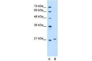 WB Suggested Anti-TCAP Antibody Titration:  5. (TCAP anticorps  (Middle Region))