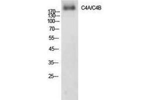 Western Blotting (WB) image for anti-Complement C4A/C4B (Internal Region) antibody (ABIN3178888) (Complement C4A/C4B (Internal Region) anticorps)