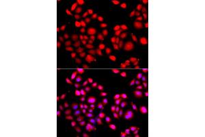 Immunofluorescence analysis of A549 cell using PRDM14 antibody. (PRDM14 anticorps)
