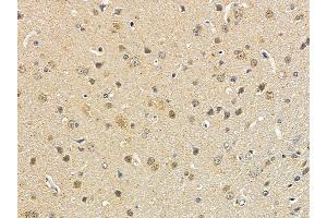 ABIN6258946 and ABIN6274560 at 1/100 staining rat brain tissue by IHC-P. (Spindlin 1 anticorps  (N-Term))