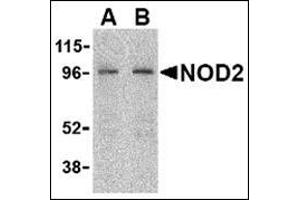 Western blot analysis of NOD2 in HeLa cell lysate with this product at (A) 2 and (B) 4 μg/ml. (NOD2 anticorps  (C-Term))