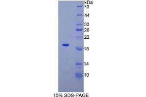 SDS-PAGE (SDS) image for Adrenoceptor alpha 1A (ADRA1A) (AA 330-466) protein (His tag) (ABIN2123948)