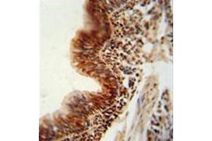 anti-RNA Binding Motif Protein 43 (RBM43) (AA 28-57), (N-Term) antibody