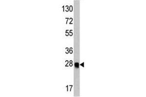 anti-Autophagy Related 12 (ATG12) antibody