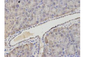 Immunohistochemistry (IHC) image for anti-Asparagine Synthetase (ASNS) antibody (ABIN1876738) (Asparagine Synthetase anticorps)