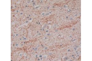 Used in DAB staining on fromalin fixed paraffin- embedded Kidney tissue