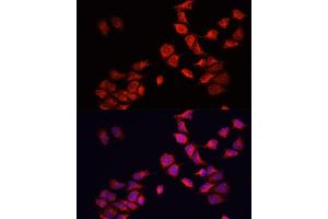 Immunofluorescence analysis of HeLa cells using BNIP3 antibody (ABIN6127502, ABIN6137620, ABIN6137621 and ABIN6221337) at dilution of 1:100. (BNIP3 anticorps  (AA 1-164))