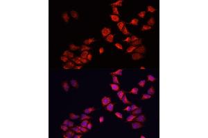Immunofluorescence analysis of HeLa cells using BNIP3 antibody (ABIN6127502, ABIN6137620, ABIN6137621 and ABIN6221337) at dilution of 1:100.