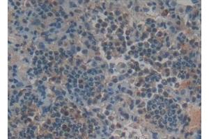 Detection of RANk in Rat Lung Tissue using Polyclonal Antibody to Receptor Activator Of Nuclear Factor Kappa B (RANk)