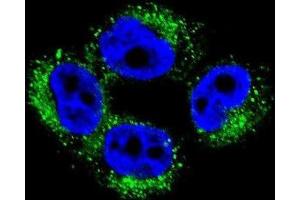 Immunofluorescence (IF) image for anti-Adaptor-Related Protein Complex 1, mu 1 Subunit (AP1M1) antibody (ABIN2996504) (AP1M1 anticorps)