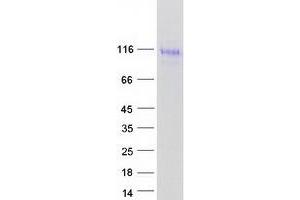 Validation with Western Blot