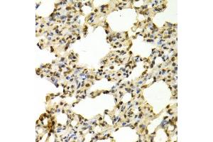 Immunohistochemistry of paraffin-embedded rat lung using PADI4 antibody (ABIN5970978) at dilution of 1/100 (40x lens). (PAD4 anticorps)