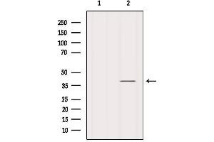 Western blot analysis of extracts from HepG2, using IkappaB-alpha Antibody.