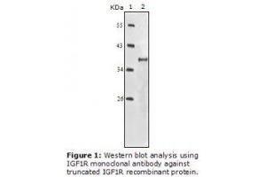 Image no. 2 for anti-Insulin-Like Growth Factor 1 Receptor (IGF1R) antibody (ABIN232138) (IGF1R anticorps)