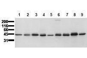 Western Blotting (WB) image for anti-Casein Kinase 1, epsilon (CSNK1E) (AA 355-380) antibody (ABIN126752)
