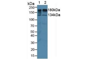 Figure. (EGFR anticorps  (AA 888-1210))