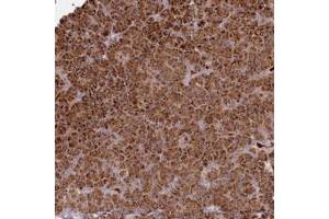 Immunohistochemical staining of human pancreas with BPIFC polyclonal antibody  shows strong cytoplasmic positivity in exocrine glandular cells. (BPIFC anticorps)