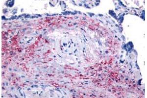 Immunohistochemistry (Formalin/PFA-fixed paraffin-embedded sections) of human placenta with NET1 polyclonal antibody . (NET1 anticorps  (Internal Region))