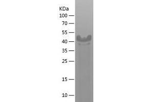 Western Blotting (WB) image for Exostosin 2 (EXT2) (AA 46-264) protein (His-IF2DI Tag) (ABIN7122866)