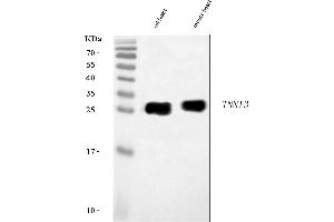 Western blot analysis of Cardiac Troponin I/TNNI3 using anti-Cardiac Troponin I/TNNI3 antibody (ABIN7602860).