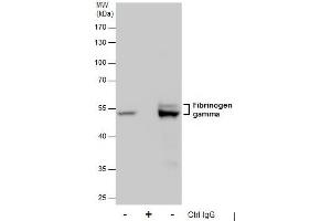 IP Image Immunoprecipitation of Fibrinogen gamma protein from HepG2 whole cell extracts using 5 μg of Fibrinogen gamma antibody, Western blot analysis was performed using Fibrinogen gamma antibody, EasyBlot anti-Rabbit IgG  was used as a secondary reagent. (FGG anticorps)