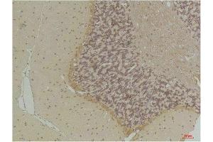 Immunohistochemical analysis of paraffin-embedded Rat BrainTissue using GABA Transporter 1 Rabbit pAb diluted at 1:200. (SLC6A1 anticorps)