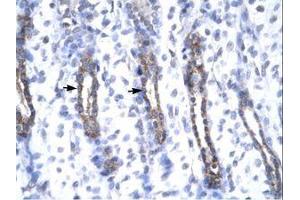 Image no. 2 for anti-Matrix Metallopeptidase 19 (MMP19) (AA 56-105) antibody (ABIN6735807) (MMP19 anticorps  (AA 56-105))