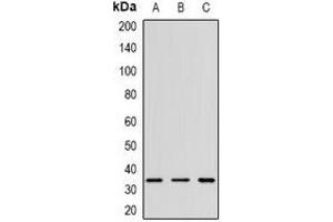 Western blot analysis of CD152 expression in K562 (A), mouse spleen (B), rat thymus (C) whole cell lysates. (CTLA4 anticorps)
