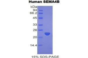 SDS-PAGE analysis of Human Semaphorin 4B Protein.