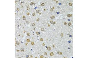 Immunohistochemistry of paraffin-embedded mouse brain using RNASEL antibody. (RNASEL anticorps)