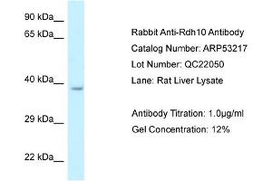 Western Blotting (WB) image for anti-Retinol Dehydrogenase 10 (All-Trans) (RDH10) (C-Term) antibody (ABIN2785295) (RDH10 anticorps  (C-Term))