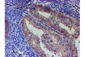 Image no. 1 for anti-Paraneoplastic Antigen MA3 (PNMA3) (AA 1-250) antibody (ABIN1490635) (PNMA3 anticorps  (AA 1-250))