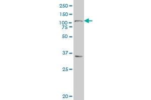 MARCH6 polyclonal antibody (A01), Lot # 051107JC01 Western Blot analysis of MARCH6 expression in MES-SA/Dx5 .