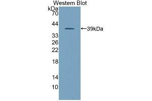 Western blot analysis of the recombinant protein. (PITPNB anticorps  (AA 2-271))