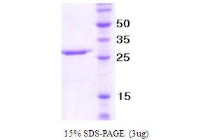 SDS-PAGE (SDS) image for Neutrophil Migration (NM) (AA 22-255) protein (ABIN666806) (Neutrophil Migration (NM) (AA 22-255) Protéine)