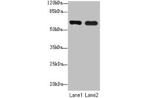Western blot All lanes: SPTLC3 antibody at 0.