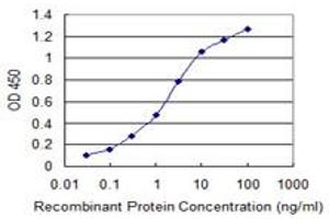 Detection limit for recombinant GST tagged SIX4 is 0. (SIX4 anticorps  (AA 672-780))