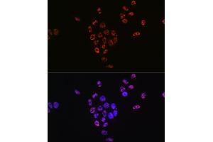 Immunofluorescence analysis of HeLa cells using Phospho-p70 S6 Kinase 1-T421/S424 antibody (ABIN6135340, ABIN6136296, ABIN6136297 and ABIN7101878).