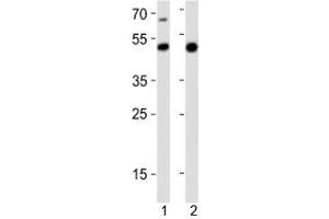 Western blot analysis of lysate from 1) mouse heart and 2) rat stomach tissue lysate using Gata6 antibody at 1:1000. (GATA6 anticorps  (C-Term))