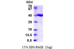 Zinc Binding Alcohol Dehydrogenase Domain Containing 2 (ZADH2) (AA 33-377) protein (His tag)