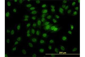 Immunofluorescence of monoclonal antibody to CSE1L on HeLa cell. (Exportin 2 anticorps  (AA 872-971))