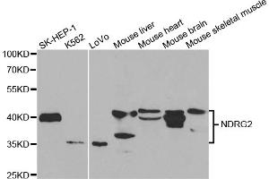 Western blot analysis of extracts of various cell lines, using NDRG2 antibody (ABIN5973062) at 1/1000 dilution. (NDRG2 anticorps)