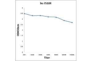 anti-Ribonuclease/angiogenin Inhibitor 1 (RNH1) (AA 101-200) antibody