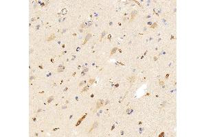 IHC analysis of SLC25A13 using anti-SLC25A13 antibody (ABIN7599512). (slc25a13 anticorps  (AA 1-643))