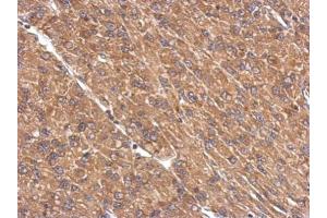 IHC-P Image Immunohistochemical analysis of paraffin-embedded U87 xenograft, using PPP2R1A, antibody at 1:500 dilution. (PPP2R1A anticorps  (Center))