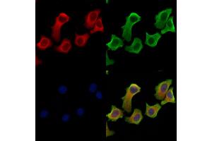 ABIN6264961 and ABIN6279698 staining Hela cells by IF/ICC. (SEC61B anticorps  (N-Term))
