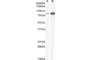 ABIN185407 (1µg/ml) staining of Mouse Pancreas (A) and Rat Stomach (B) lysate (35µg protein in RIPA buffer).