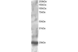 ABIN184739 staining (1µg/ml) of HepG2 lysate (RIPA buffer, 30µg total protein per lane). (RGS1 anticorps  (C-Term))