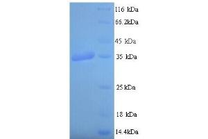 SDS-PAGE (SDS) image for PDZ and LIM Domain 7 (Enigma) (PDLIM7) (AA 185-386) protein (His tag) (ABIN5714018)
